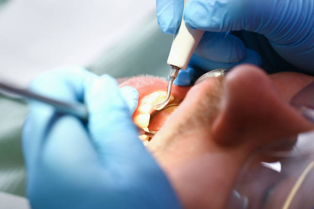 Best Holiday Emergency Dentist in White Oak, MS