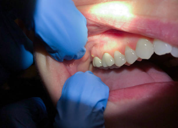 Best Mobile Emergency Dentist in White Oak, MS