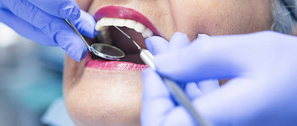 Best Emergency Dentist for Lost Fillings or Crowns in White Oak, MS